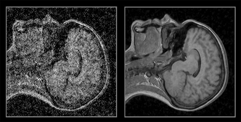 Deep-Learning-Rekonstruktion